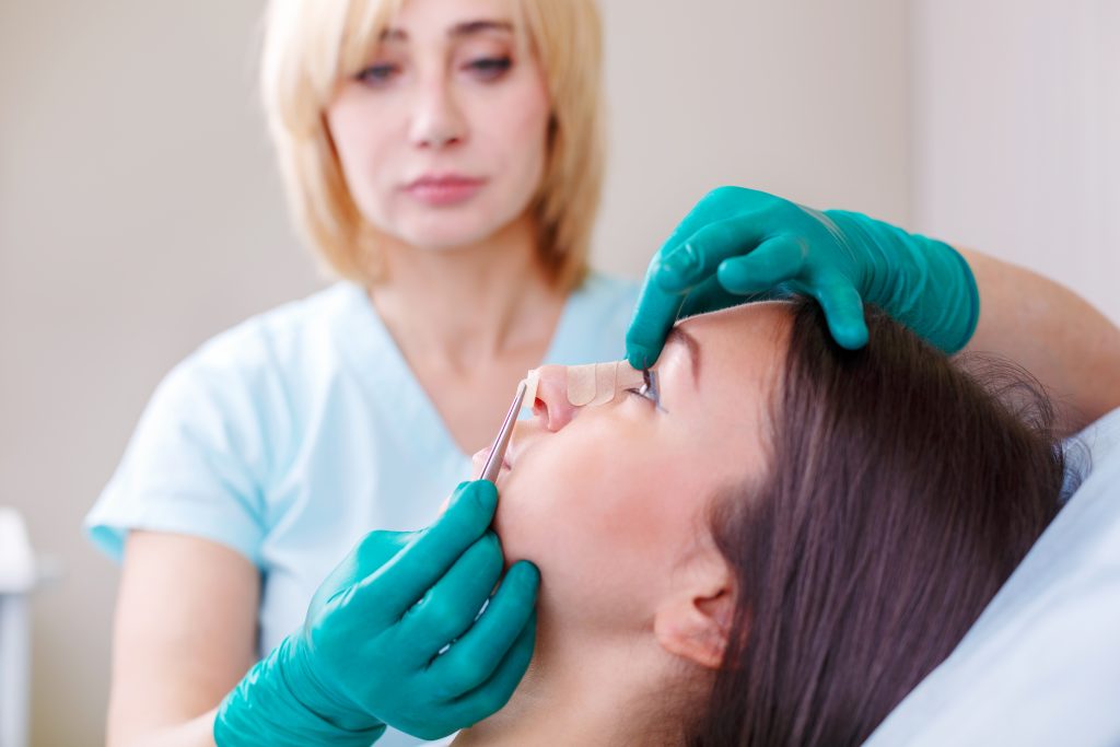 Rhinoplasty
