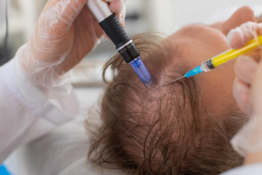 Mesotherapy