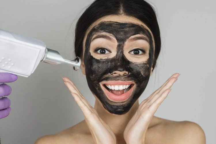Carbon Peel