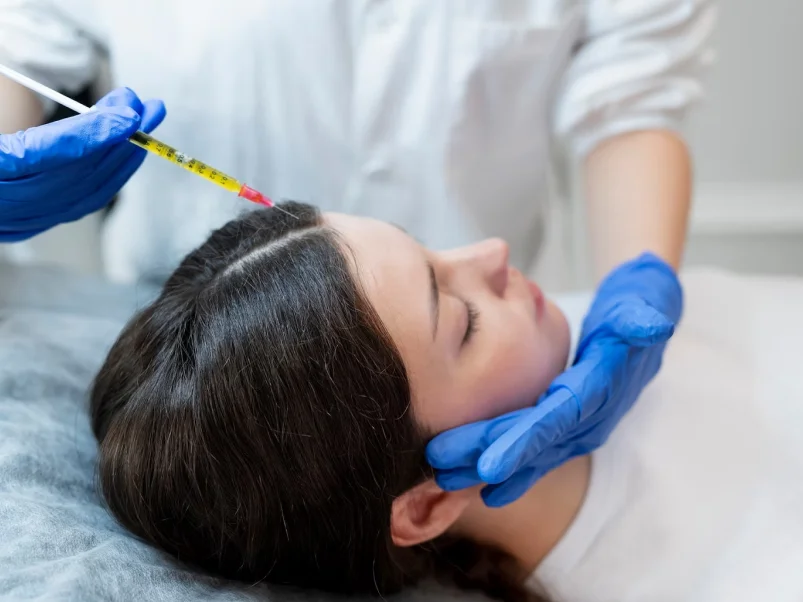 Mesotherapy for Hair & Scalp Health Mesotherapy for Hair & Scalp Health