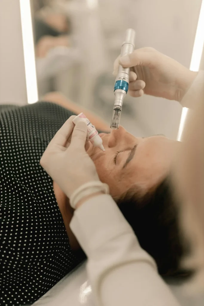 Infini RF Microneedling