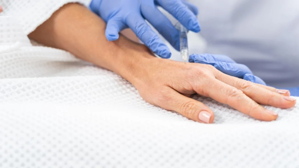 Restylane Vital for Hands