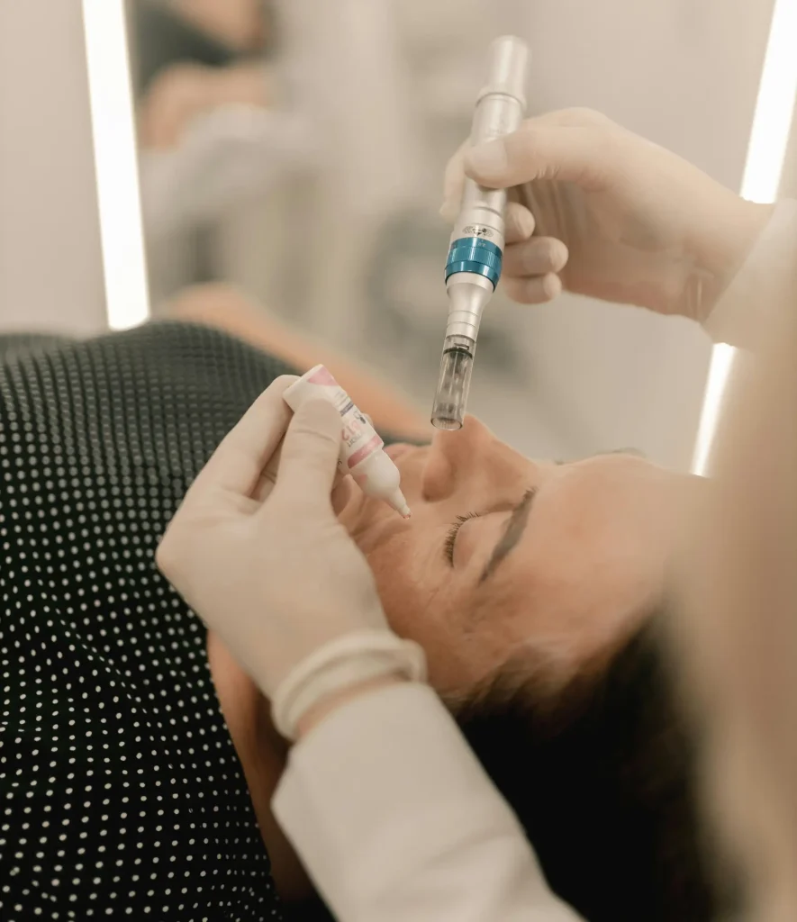 Infini RF Microneedling